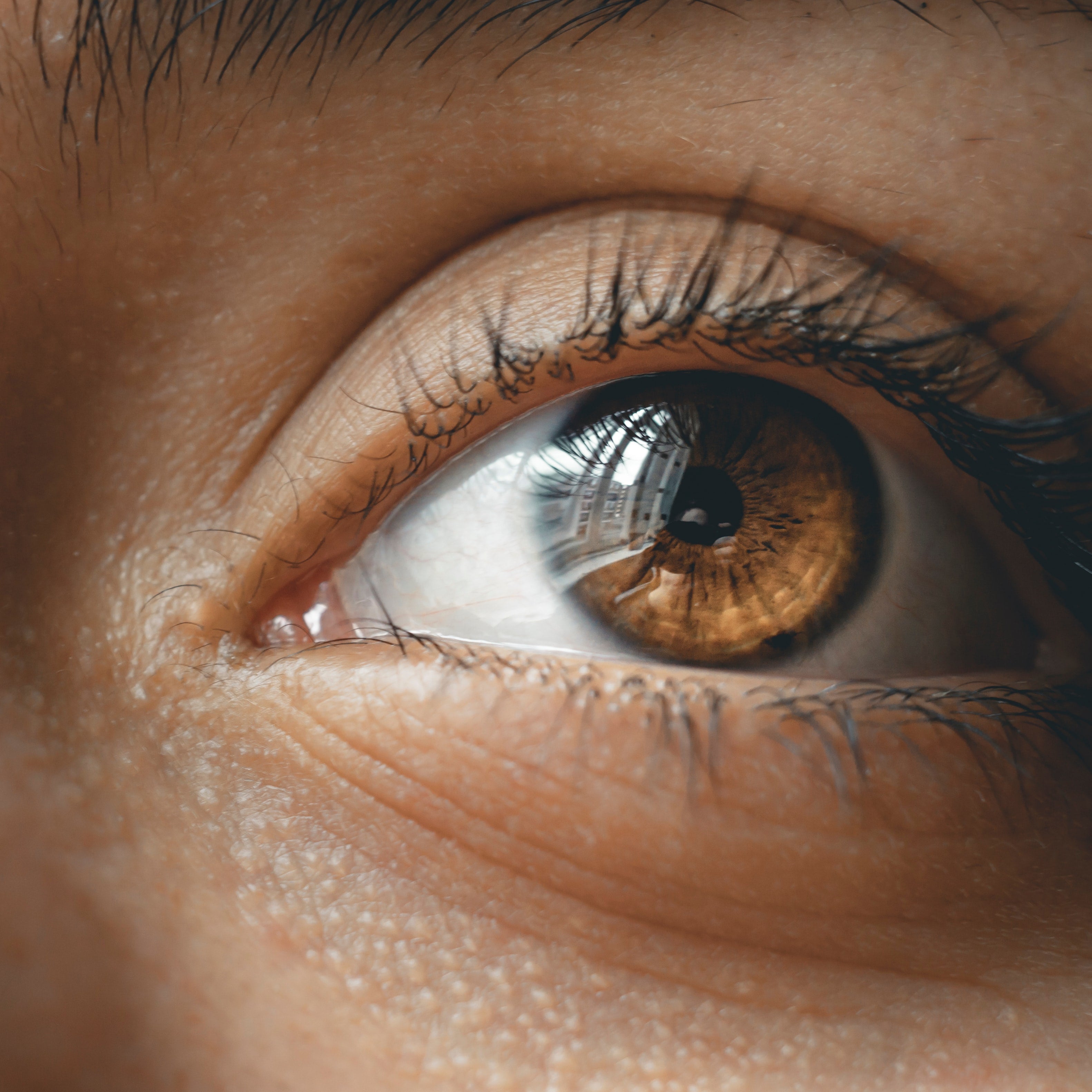 Macular Degeneration Explained